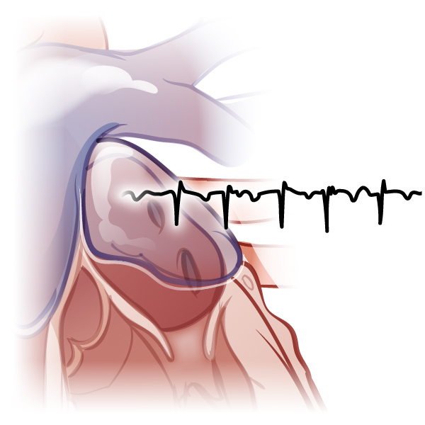 NEJM Illustrated Glossary