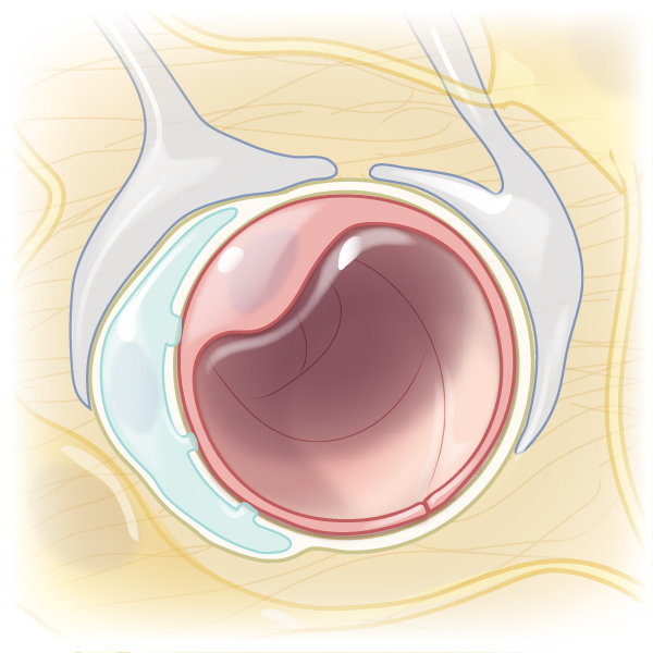 NEJM Illustrated Glossary