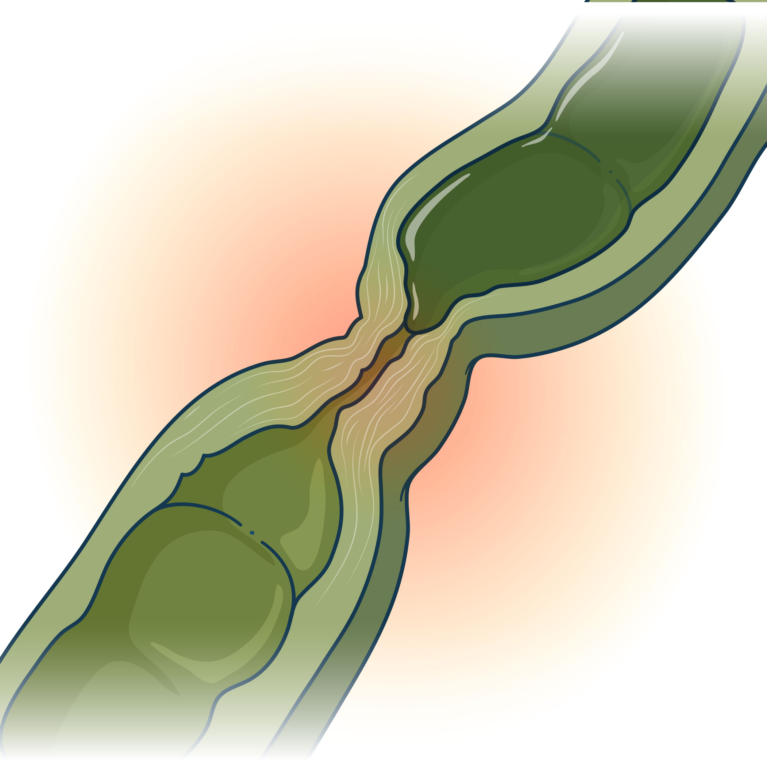 MOST COMMON CAUSE OF CHOLESTASIS visual data 8