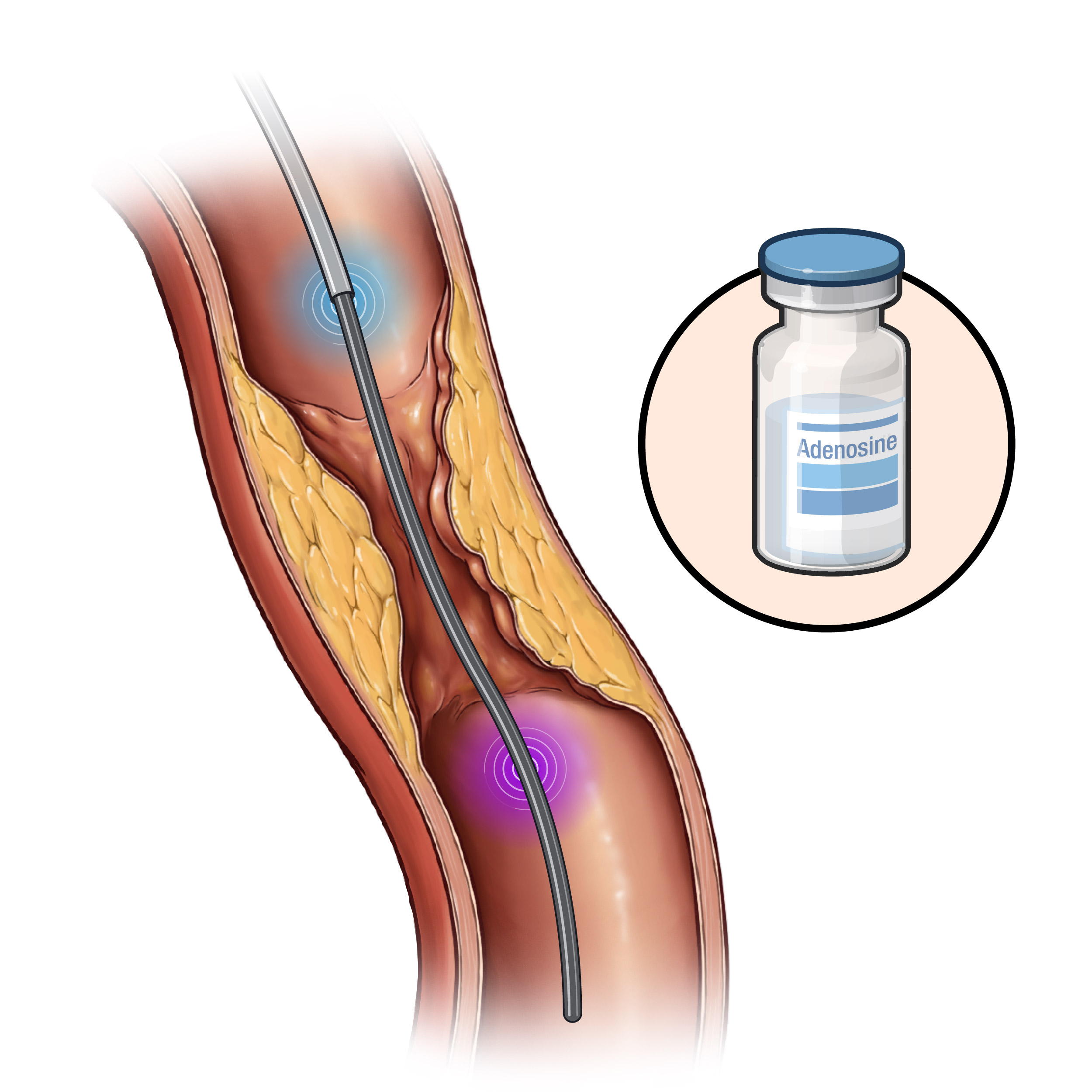 NEJM Illustrated Glossary